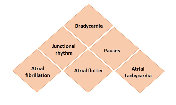 Arrhythmias associated 